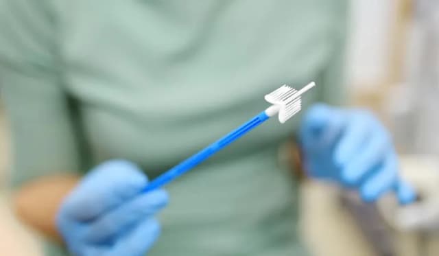 Ile kosztuje cytologia na NFZ? Dowiedz się, kto nie płaci!